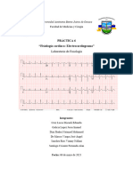 Electrocardiograma Practica 6