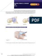 8 - Artroscopia de Cadera para El Choque Femoroacetabular