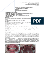 6.B.CBA03.PDOR00 Bệnh sâu răng ở trẻ em