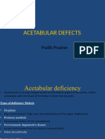 Acetabular Defects