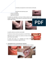 Patología Del Labio y de La Lengua