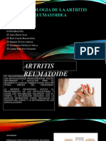 FP Artritis Reumatoidea