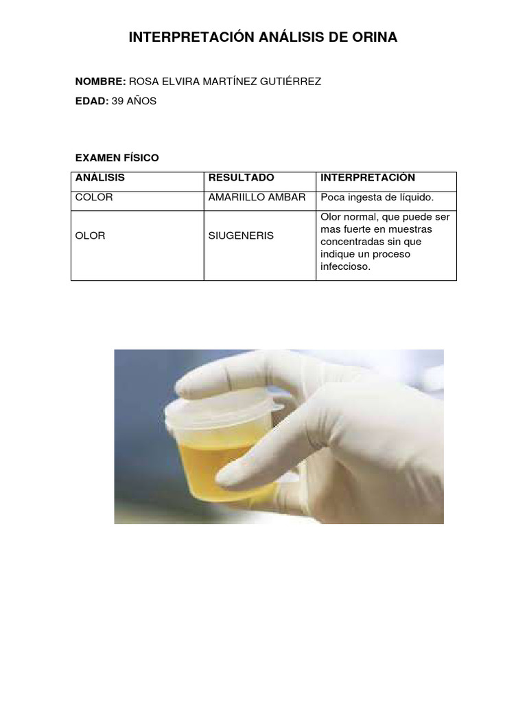 Interpretación Análisis de Orina | PDF | Orina | Especialidades Medicas