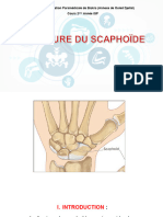 Fracture Du Scaphoïde Carpien