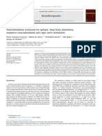 Neuroestimulación para Epilepsia