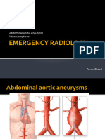 Emergency Radiology: Abdominal Aortic Aneurysm Intussusceptions