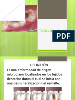 Caries Dental