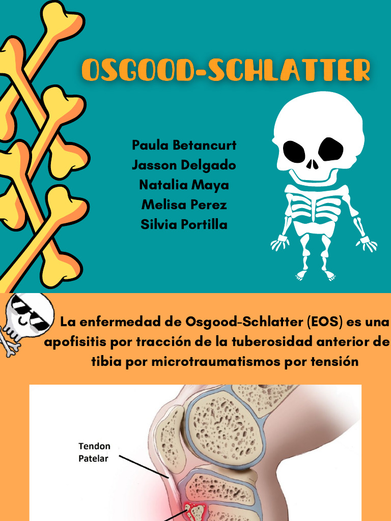 Osgood Schlatter | PDF | Rodilla | Medicina CLINICA