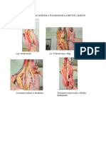 LP 2 CTRL Leziuni Pulmonare