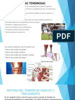 Lesiones Tendinosas