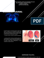 Derrame Pleural Ivss