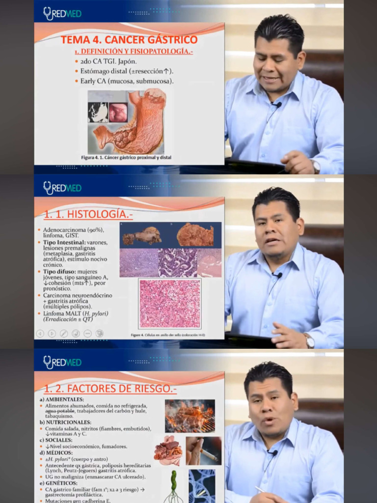 1 4 Cancer Gastrico Pdf