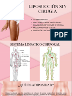 Liposucción Sin Cirugia