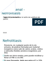 Litiasis Renal - Nefrolitiasis