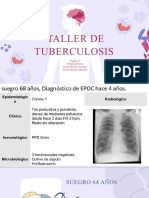 Taller de Tuberculosis