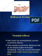 Newborn Reflexes