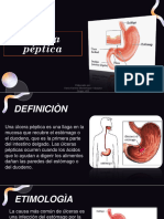 Úlcera Péptica