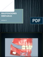 Malposiciones dentarias