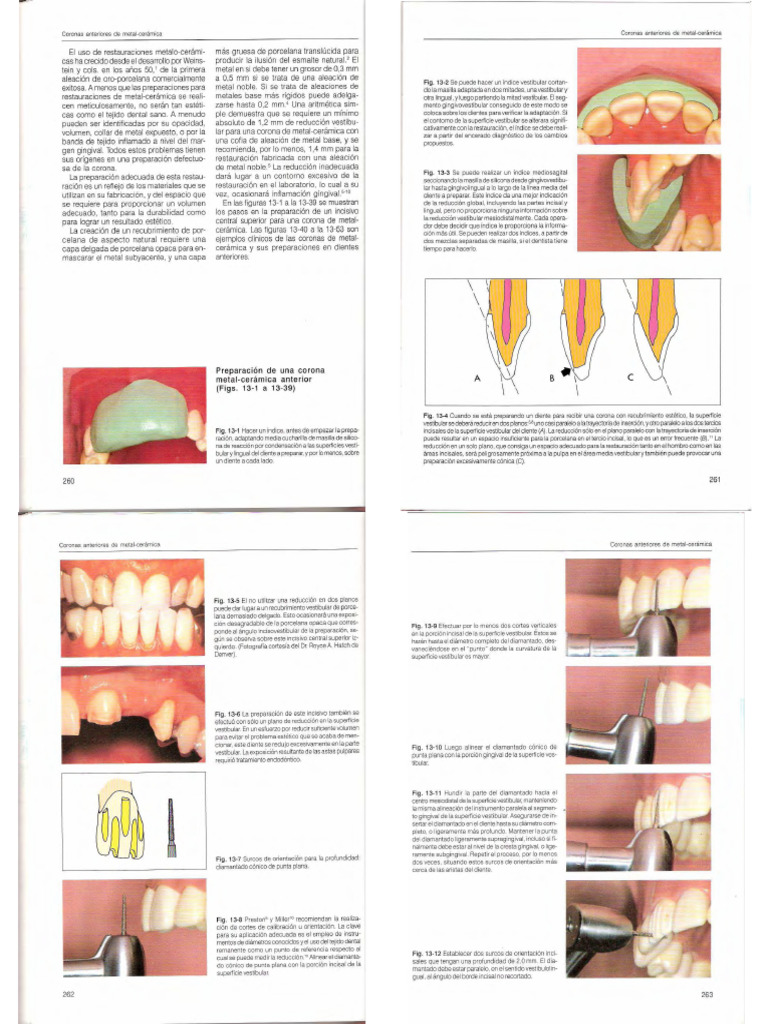 Coronas | PDF