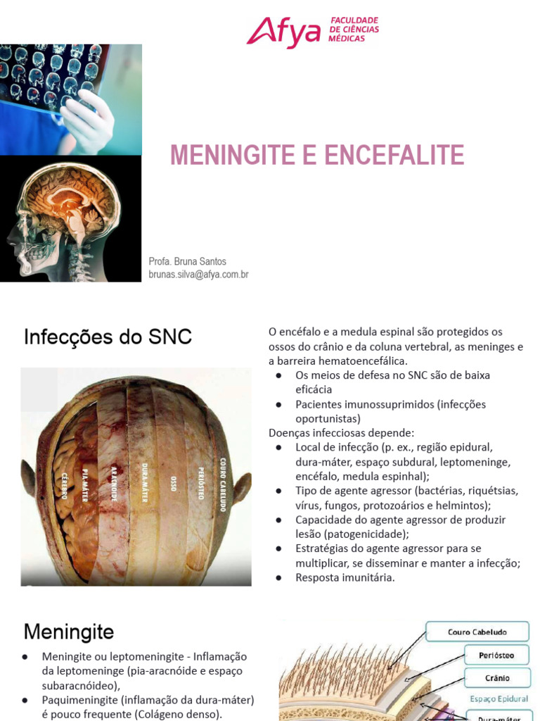 Meningite e Encefalite: Causas e Tratamentos | PDF | Meningite | Vírus