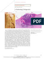 Acquired Reactive Perforating Collagenosis