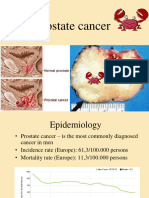5.12 Prostate Cancer