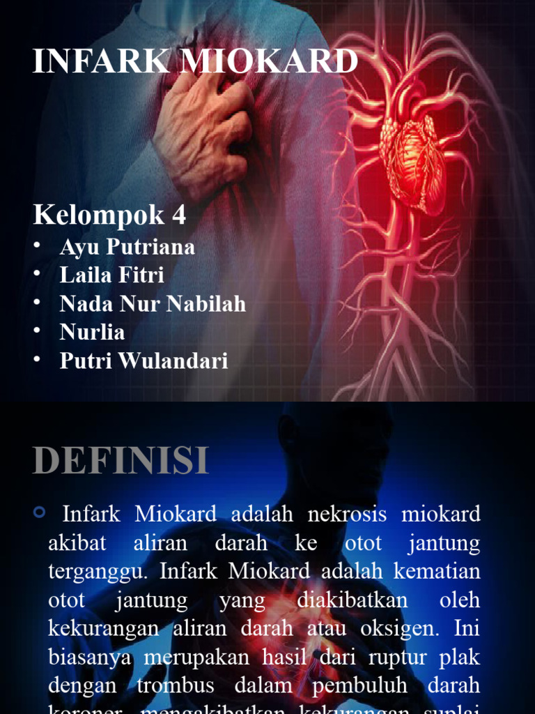 Pemahaman Infark Miokard dan Penanganannya | PDF | Sains & Matematika