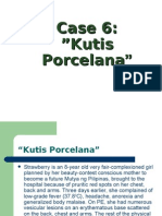 Kutis Porcelana