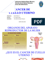 cancer de cuello uterino