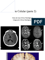Caso 3 Muerte Celular (Parte 2)