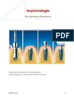 Implantologie: Die Künstliche Zahnwurzel