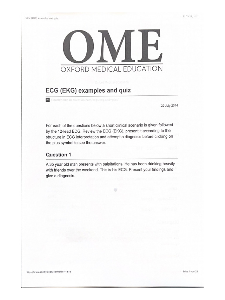 ECG (EKG) Examples and Quiz 2 | PDF