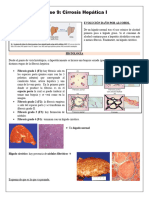 Cirrosis Hepática Parte 1