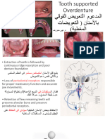 طباعة- التعويضات الفوقية