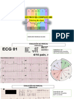 Ejercicios Tarea Eje QRS