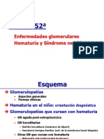 Glomerulonefritis