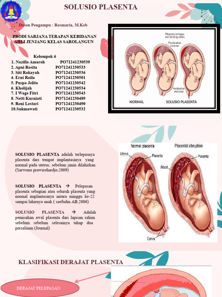 Klasifikasi dan Penanganan Solusio Plasenta | PDF | Kesehatan Holistik ...