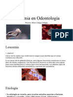 Leucemia en Odontología