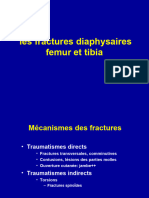 1-Fractures - Femur Et Tibia