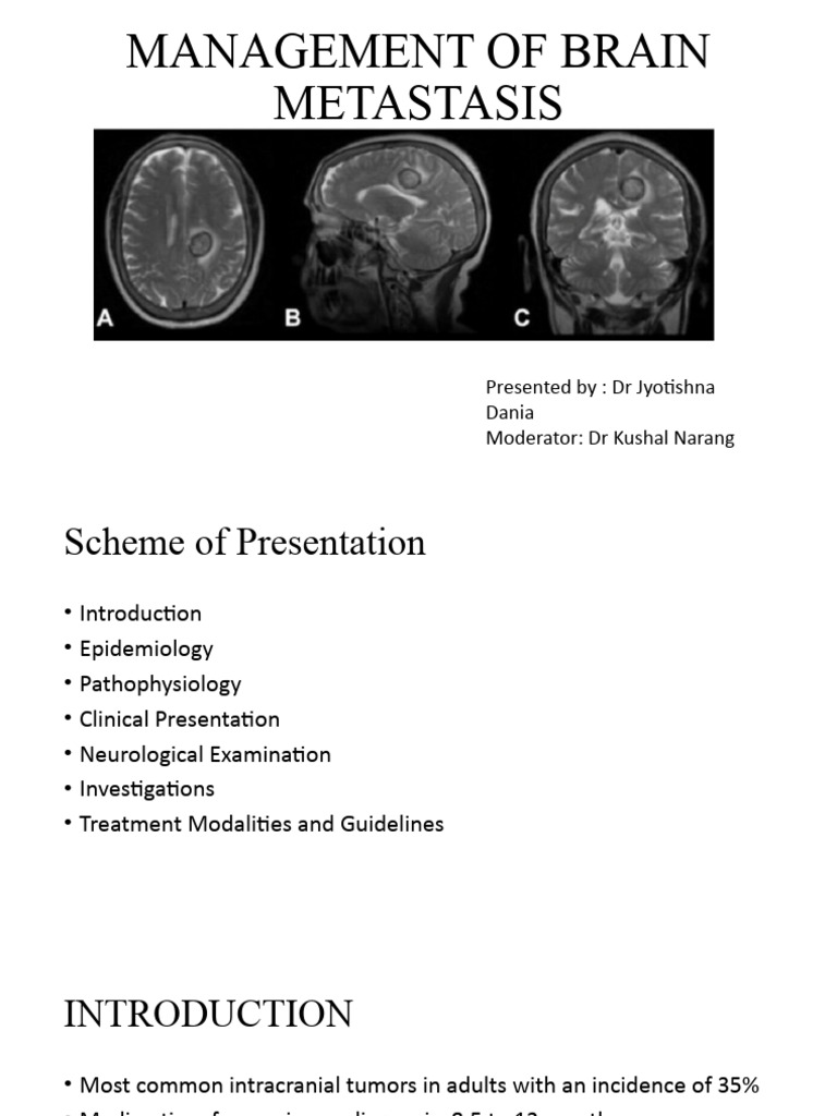 Management of Brain Metastasis Overview | PDF | Metastasis | Brain Tumor