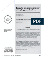 CT Pterygopalatine Fossa