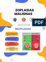 Neoplasias Malignas