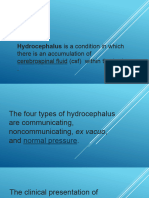 Hydrocephalus