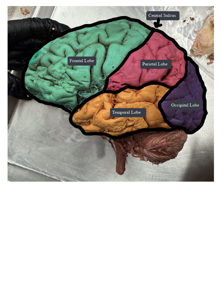 Neuroanatomy Gyri Drawings - Maya Greenquist | Download Free PDF ...