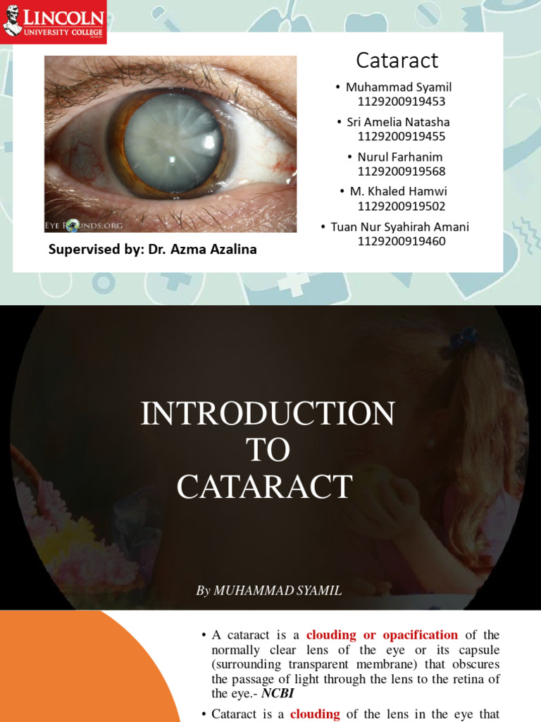 Cataract Download Free Pdf Clinical Medicine Medical Specialties