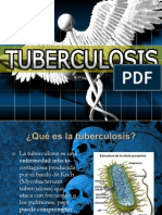 Tuberculosis