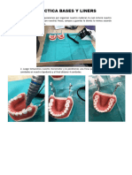 Bases y Liners Practica