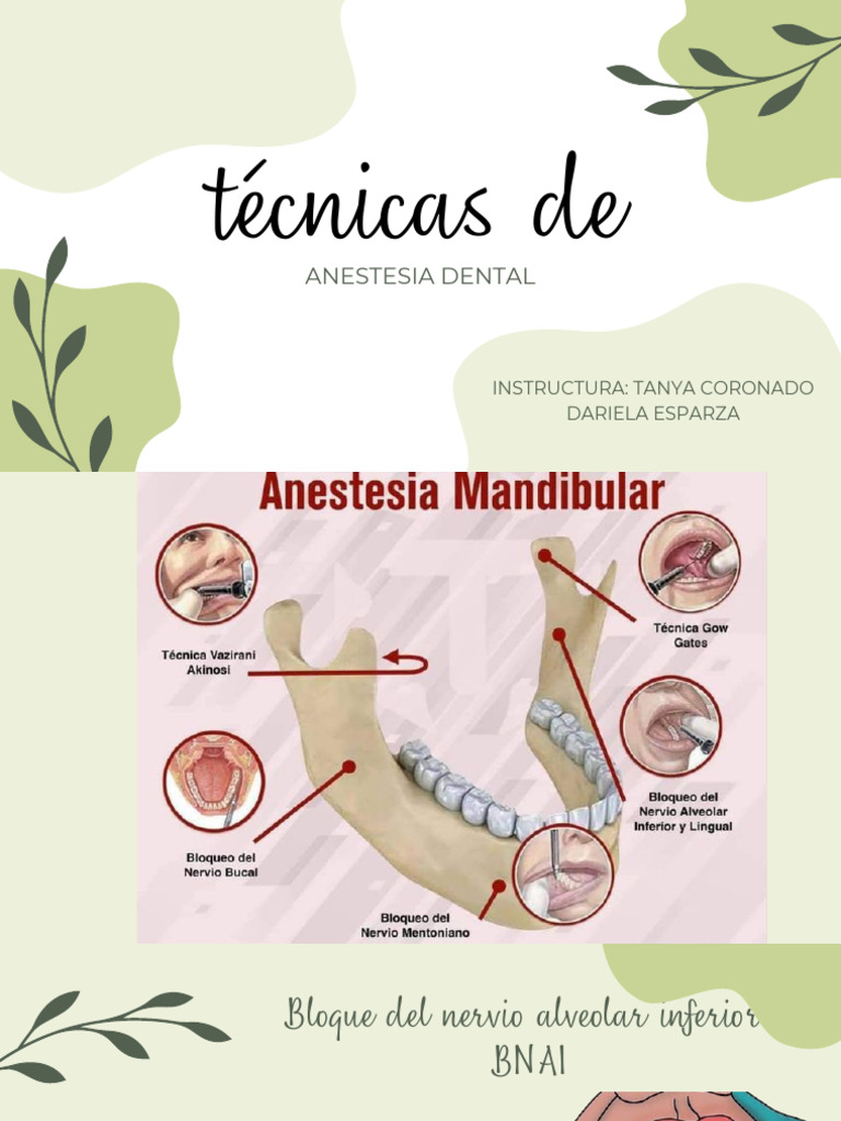 Técnicas de Anestesia Mandibular | PDF | Anatomia dental | Cabeza y ...
