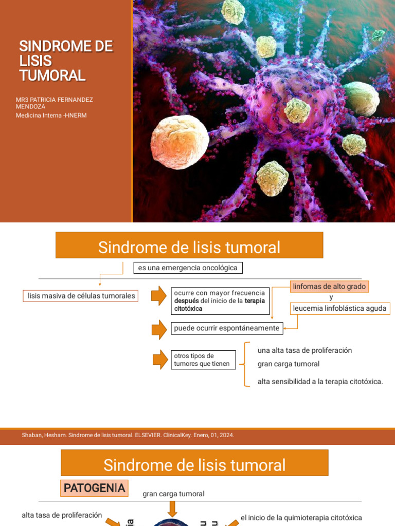 SINDROME DE LISIS TUMORAL PDF Cáncer Especialidades Medicas