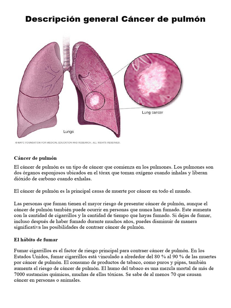 Cáncer de pulmón: causas y riesgos | PDF | Cáncer de pulmón | Cáncer